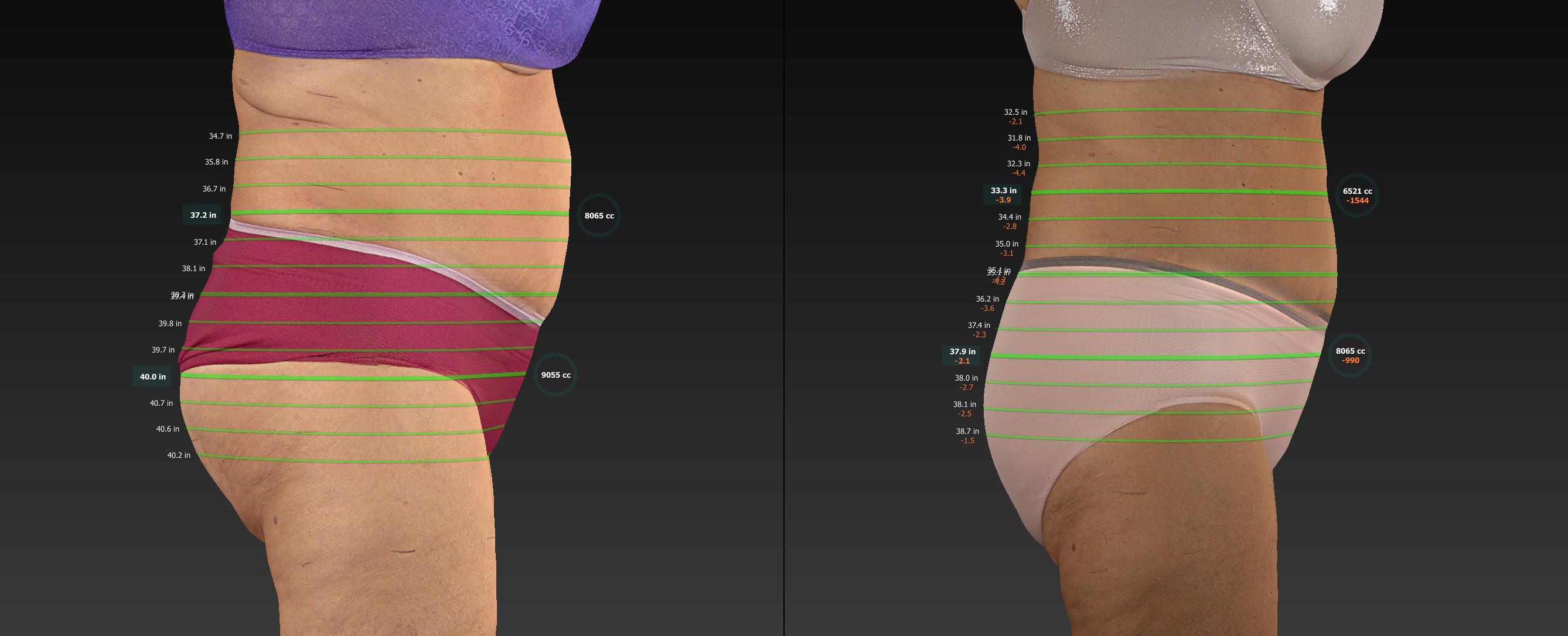 Diane lost 20.5 inches