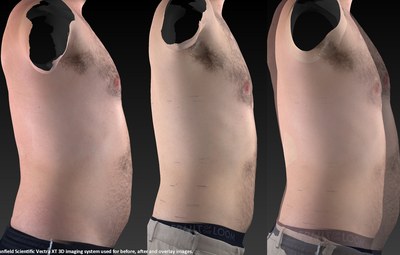 Chris lost 20.5 inches