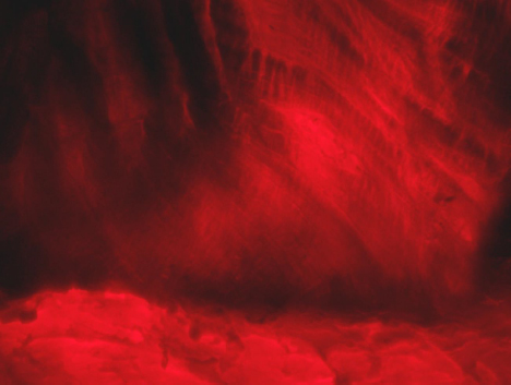 UltraSlim<sup>&reg;</sup> Prototype