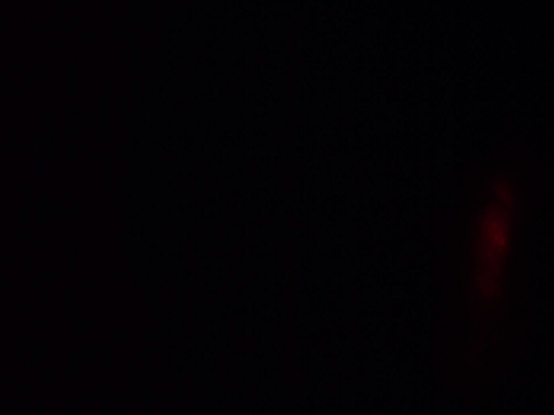 Zerona<sup>&reg;</sup> Laser